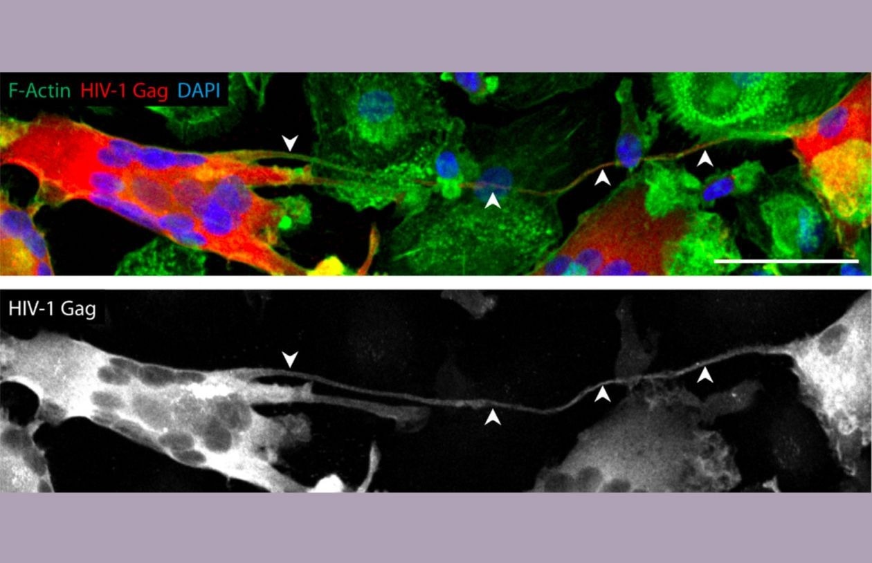 Images of tunneling nanotubes. Arrows pointing to the tunneling nanotubes. Tunneling nanotubes in immune cells, CC BY 4.0, Confocal image of day 13 HIV-1-infected human monocyte-derived macrophages and MGC interconnected through a TNT. Arrowheads show a TNT. HIV-1 Gag (red), F-actin (green), DAPI (blue). Scale bar, 50 µm.