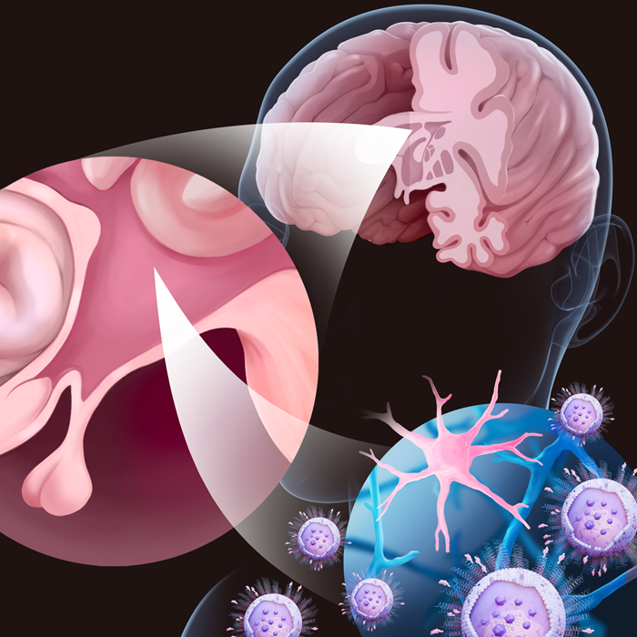 Study Shows Potential for New Treatments for Neurological and Inflammatory Diseases