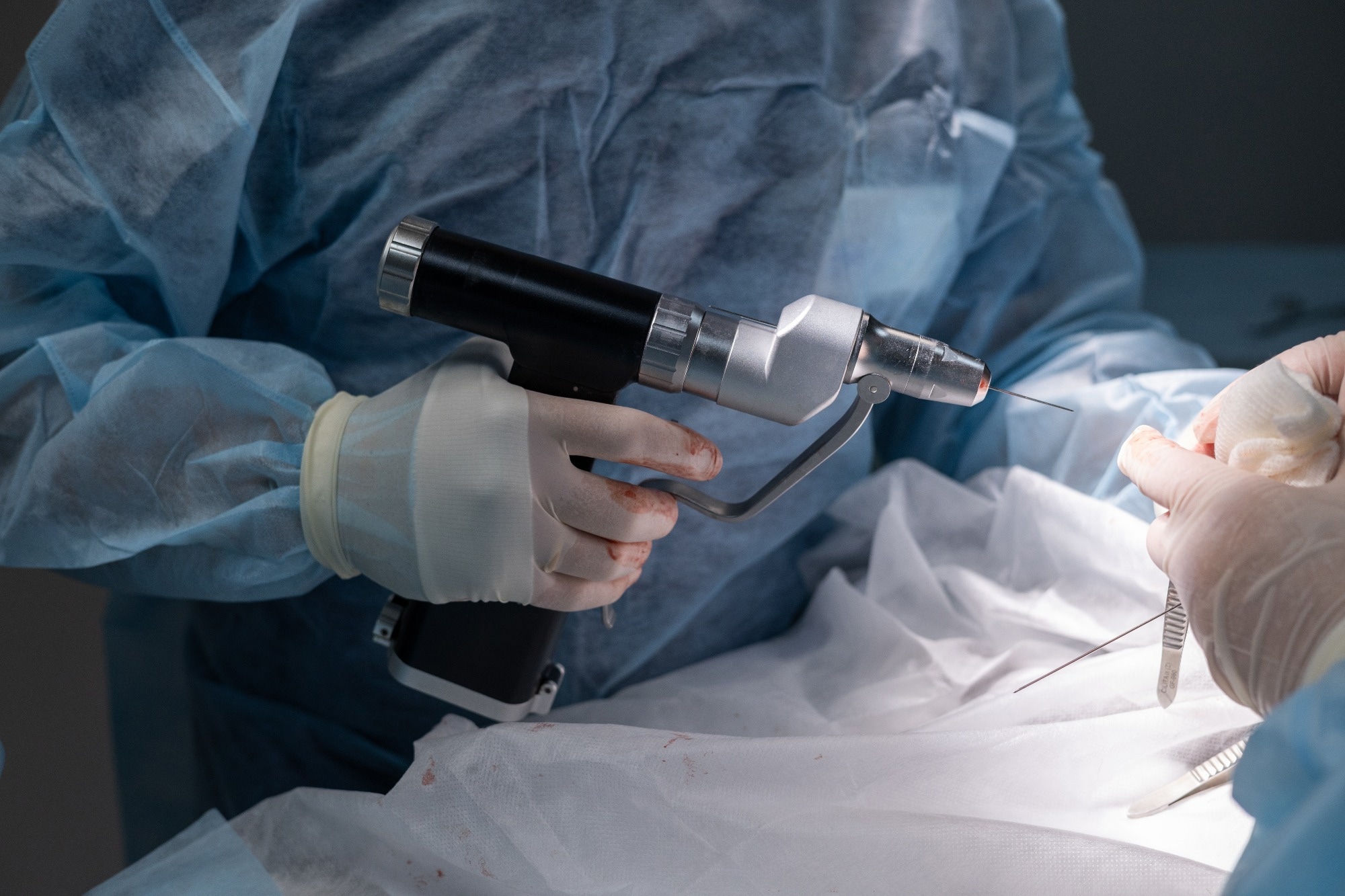 A surgeon holds a surgical drill and needle as they prepare to start the drilling procedure.