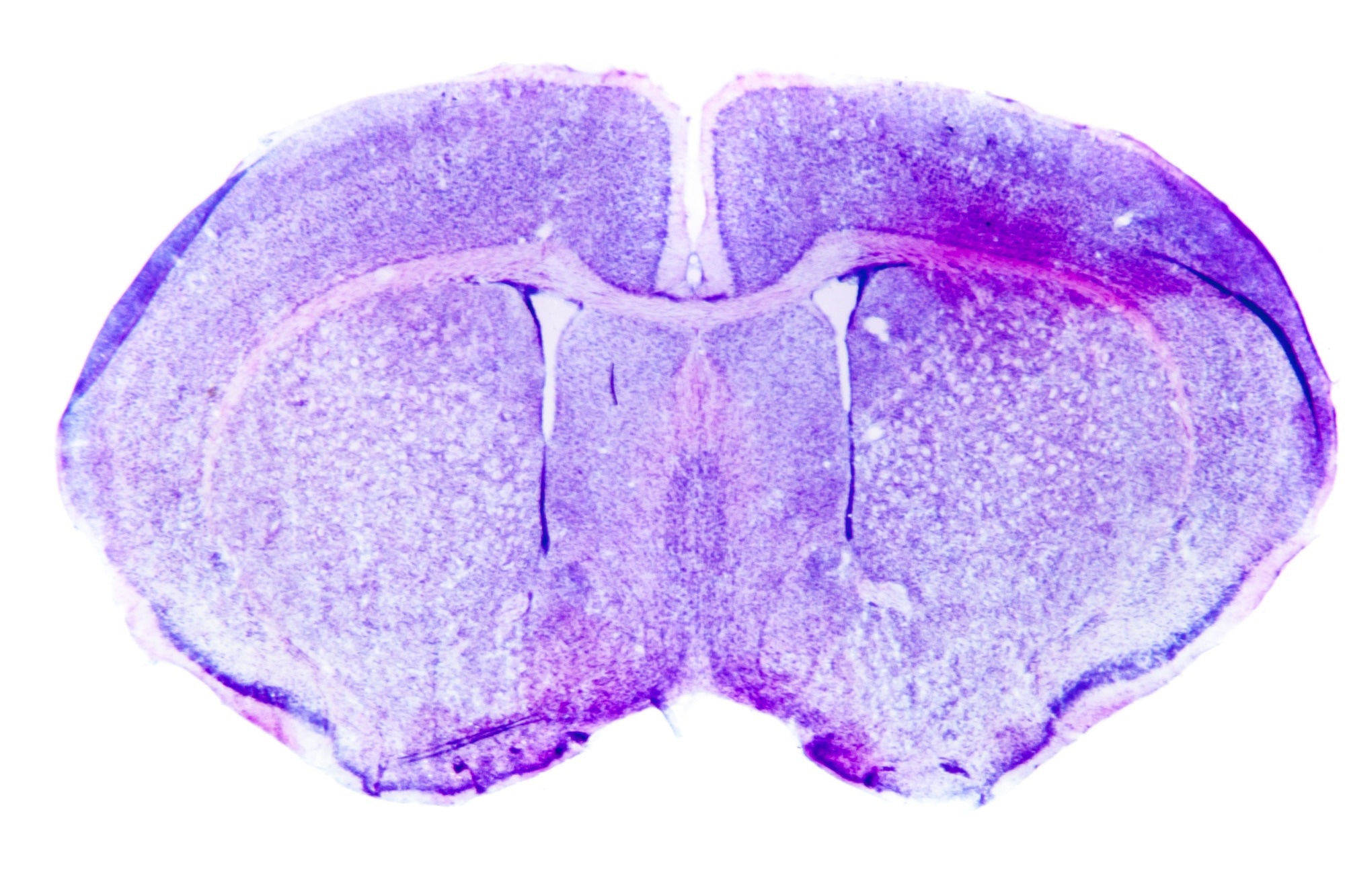 Micrograph of a rat brain.