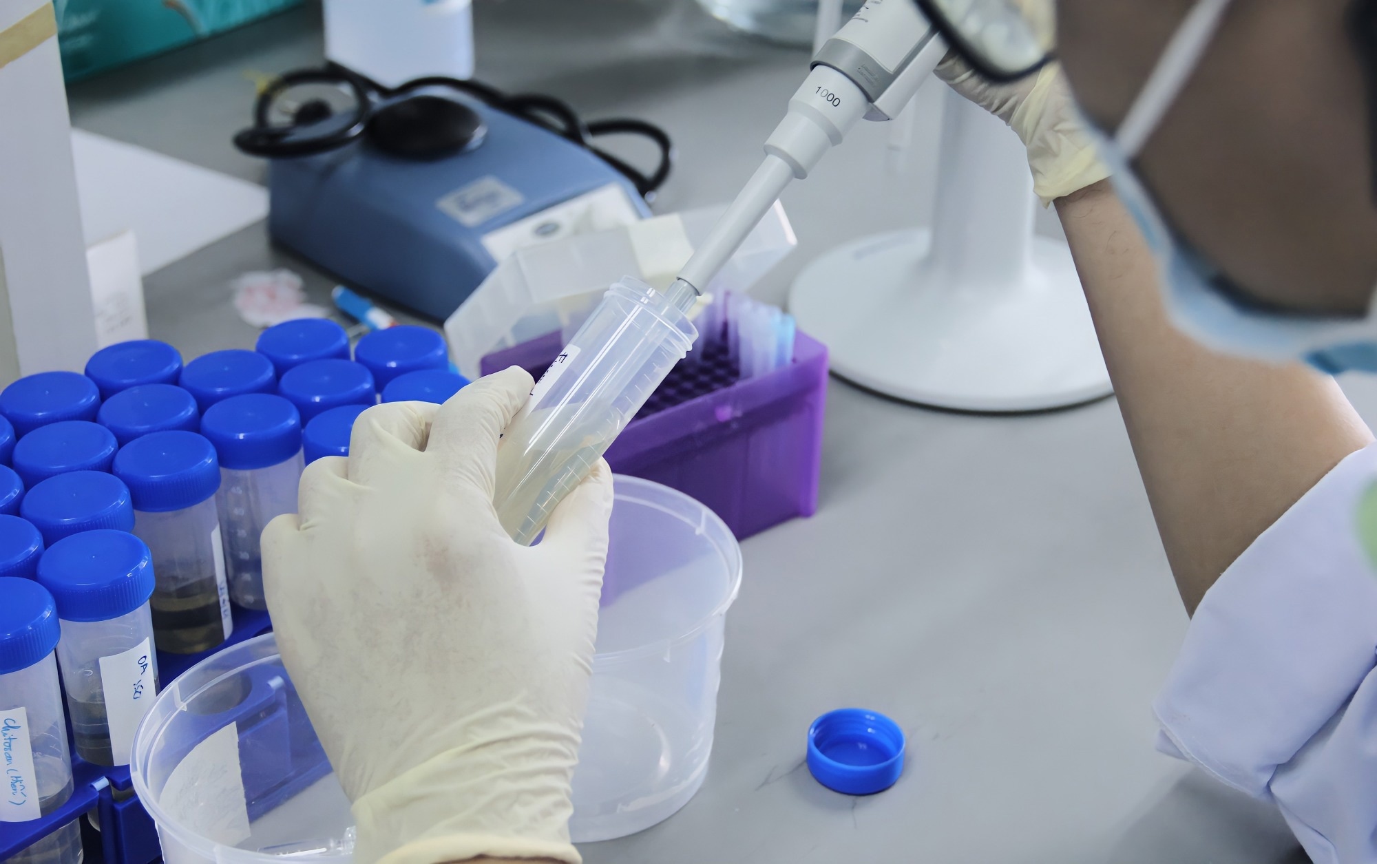 Scientist in Goggles Using Micro Pipette for Test Analysis.