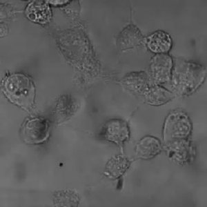Nano-Discs Destroy Cancer Cells