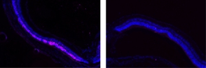 Peptide-Carrying Nanoparticles Cure Degenerative Eye Disorders