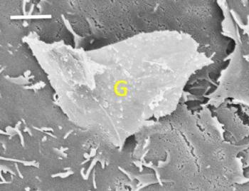 Jagged Edges of Graphene Dangerous to Human Cells