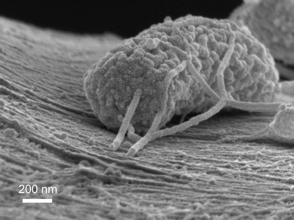 Microbes Make Nanowires to Dump Off Excess Electrons to Generate Electricity