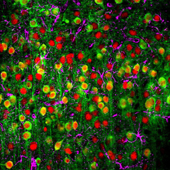 Two-Photon Microscopy Helps View Calcium Sensors in Brain Cells