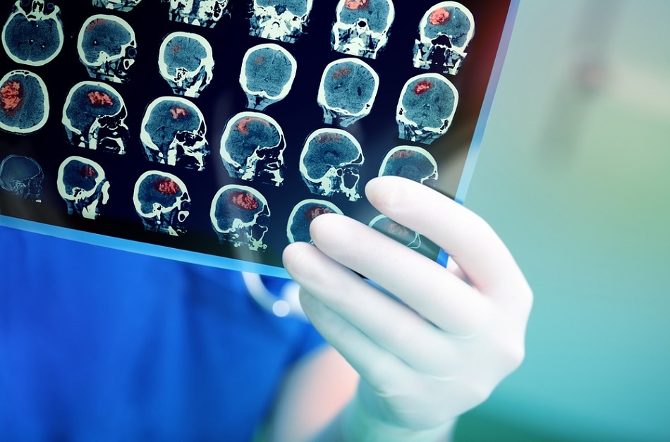 New Nanoparticles Serve as Improved Contrast Agents for MRI