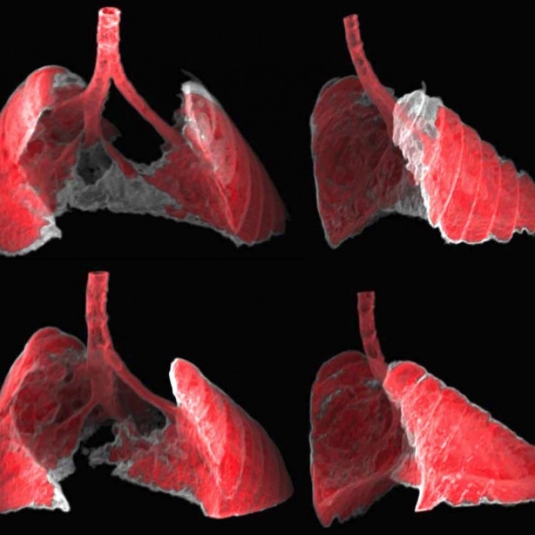 New Nano-Carrier to Discharge Drugs into Zombi Cells