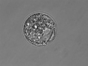 "Lab on a Chip" to Improve Success of in Vitro Fertilization