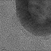 A Long-Awaited Advance Toward Applying Marvels of Nanotechnology in the Battle Against Cancer