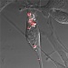Porous Polymeric Materials Increasing the Efficiency of Traditional Photocatalysts in Treatment of Cancer