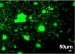 Chemotherapy and Drug Delivery to Tissues Via Tiny Nanotubes on Titanium Implants