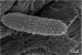 Mini Protein Chains Good Candidates as Anti-Bacterial Coating for Implants