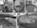 New Microsensor Giving Second-by-Second Readings of Oxygen Levels in the Brain