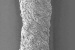 Nanotechnology Research Could Dramatically Decrease the Time Needed for Tendons to Heal