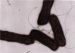 Researchers Demonstrate How Bacteria Measure Temperature