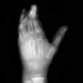 New Funding Could Lead to Development of New and Better Treatments for Broken Bones