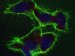 Studying Hundreds of Cell-Surface Proteins Simultaneously