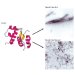 Observation Leads to Potential Insights into the Basis for Cell Damage