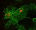 Researchers Develop New Technique to Make Movie of Bacteria Infecting Living Host