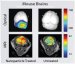 Illuminating Brain Tumors using Fluorescent Nanoparticles
