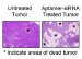 Researchers Inject siRNA into Bloodstream