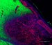 Researchers Regenerate Brain Tissue using Injectable Biomaterial Gel