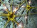 New Brain Implants Developed using Nanotechnology