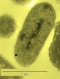 Bacterium Transforms Toxic Gold to Metallic Form by Active Cellular Mechanisms