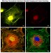 Fluorescence Microscopy Training Course on the Internet