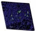 Microscopic Polymer Beads Delivering Antioxidant Enzyme into the Heart