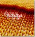 Research May Lead to New Treatment for Kidney Stones Using Biomolecules
