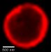 Biodegradable Nanosized Particles to Deliver Sustained-Release Medication Cargo