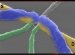 The Arrival of Superfast Quantum Computing is A Step Closer