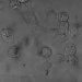 Nano-Discs Destroy Cancer Cells