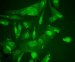Nanotechnology-Based Drug Delivery Methods Could be Used to Treat Cancer, Alzheimer's, Schizophrenia and HIV/AIDS