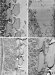 Researchers Get Up-Close Look at Pierce's Disease