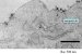 Researchers Unveil Scientific Results from siRNA Phase I Clinical Trial in Cancer Patients