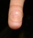 Contact Lenses Containing Vitamin E Delivering More Medication for Glaucoma