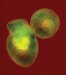 X-Ray Diffraction Microscopy Providing the Best Resolution Yet