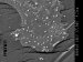 Harnessing the Power of Nanotechnology to Improve Diagnosis, Treatment, and Prevention of Cancer