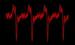 New Dark Pulse Laser Generates Light Using Quantum Dots