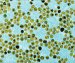 Gold Nanoparticles - Turning a Drawback into an Advantage