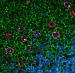 Fluorescent Quantum Dots Ideal for Detecting Rare Cancer Cells