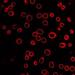 New Laser-Activated Carbon Nanoparticle System for Intracellular Drug Delivery