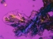 Scientists Pack Cisplatin into Nanoparticles for Use as Chemotherapy Drug