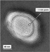 Slower Translocation of DNA Possible Through Kinked Nanopores