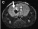 Researchers Demonstrate How Iron Oxide Nanoparticles Aid Tumor Treatment