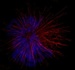 IU Bloomington Acquires New Laser-Equipped Microscope for Biological Research