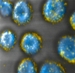 New Way for Drug Delivery into Tumors Using Nanoparticles